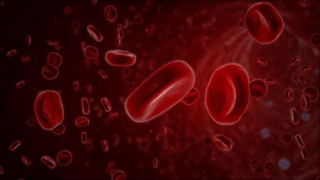 Intravenous Iron Infusion for Better Well-being