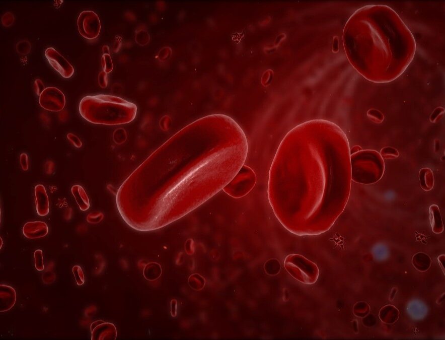 Intravenous Iron Infusion for Better Well-being
