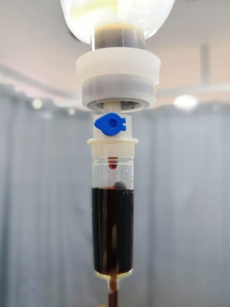 A iron infusion performed at vitamin suite