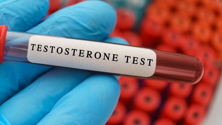 image showing tube for testosterone blood test
