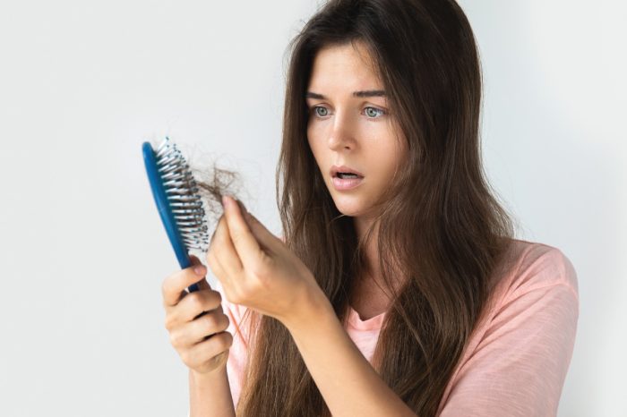 Hair loss due to Iron Deficiency